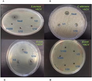 does vinegar kill e coli