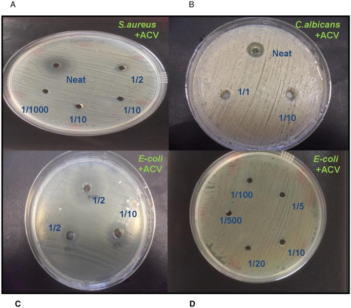 does vinegar kill e coli