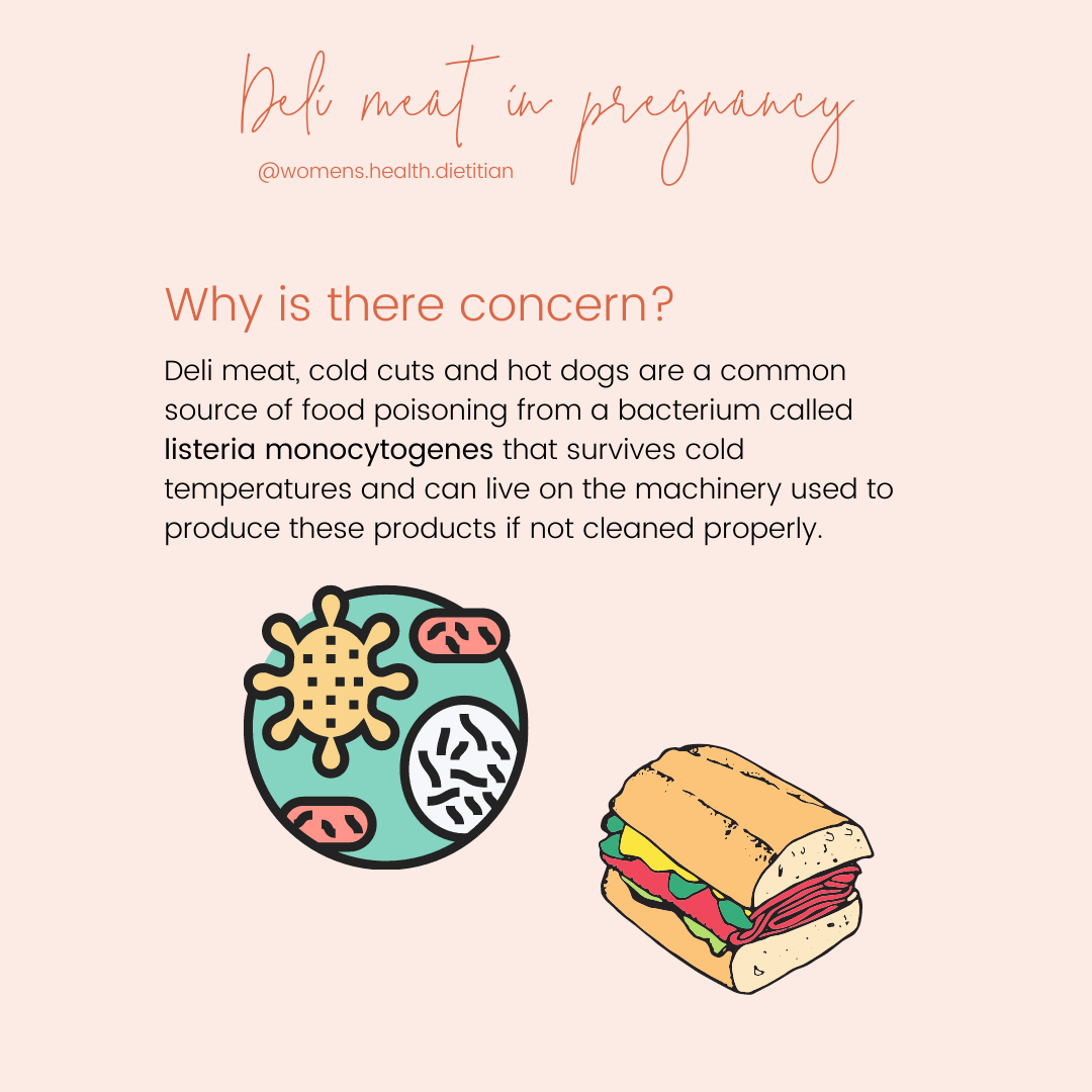 why can't you eat lunch meat during pregnancy
