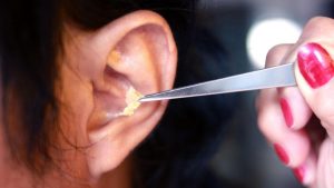 how much does it cost to get wax removed