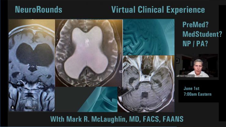 Neuro Unit Rounds what are neuro rounds - Larrea | Restaurant in Las Vegas, NV